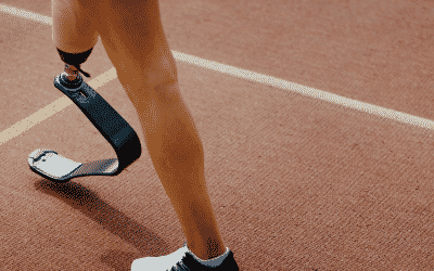 How Much Compensation For Losing A Limb?